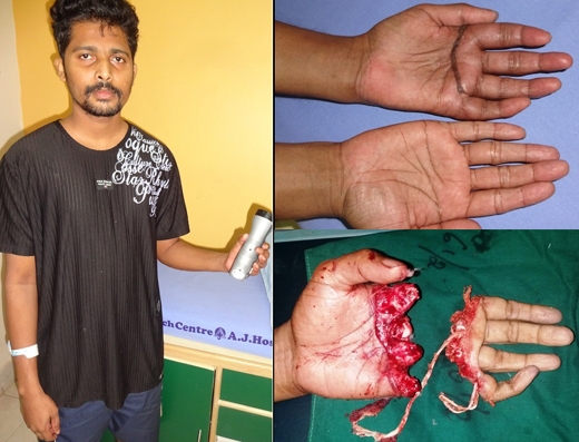 AJ Hospital rare surgery